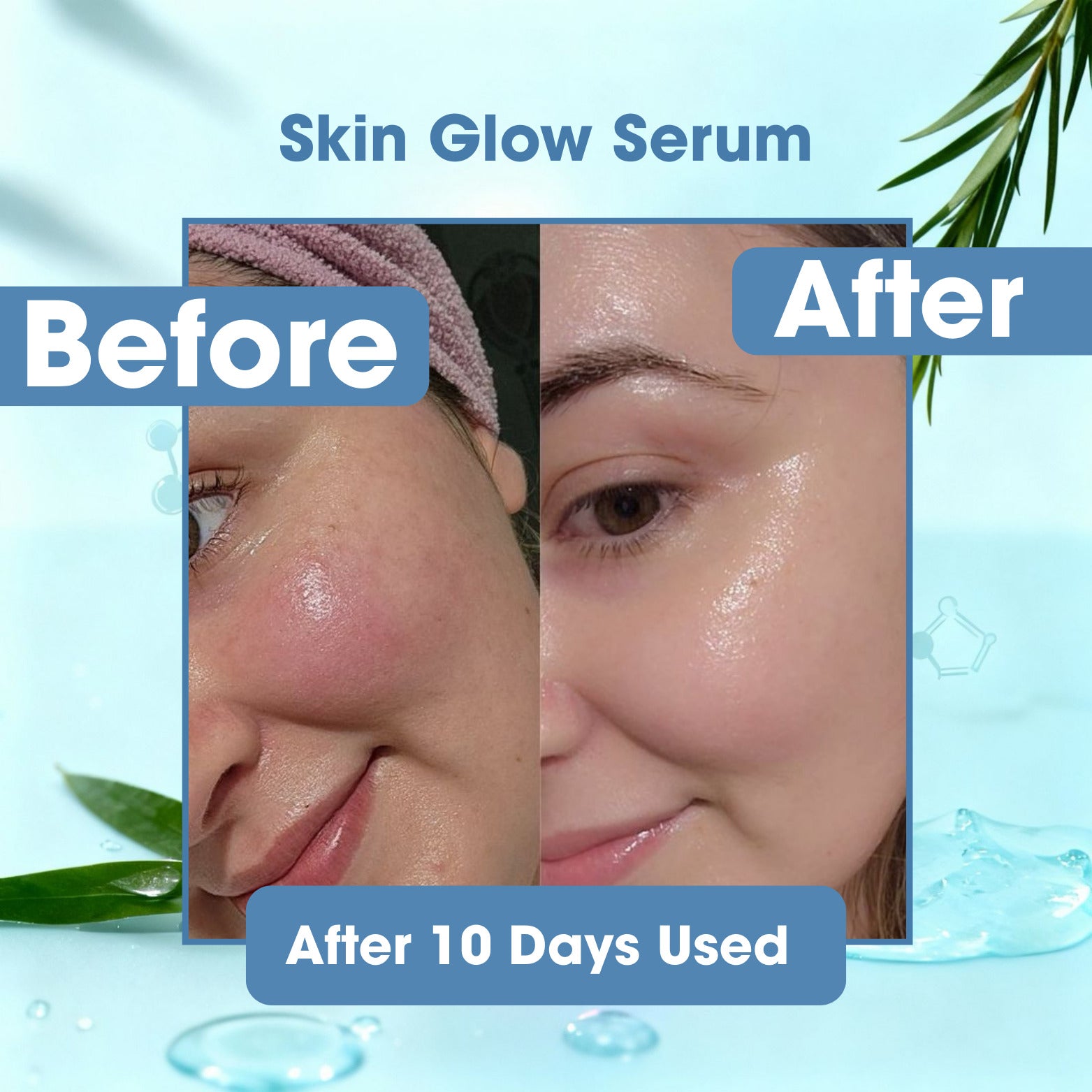 Skin Glow - Korean Glass Skin Whitening Serum