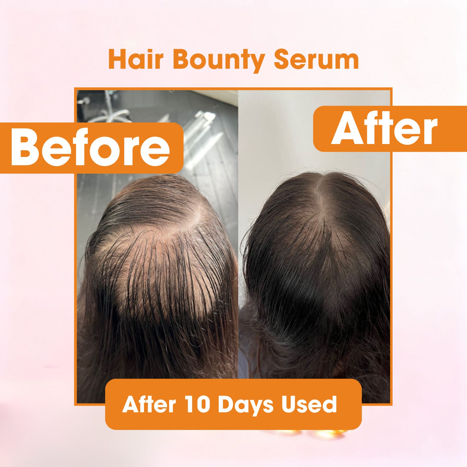 Aura Fix Total Restore Hair Serum - All in One Solution for Hair